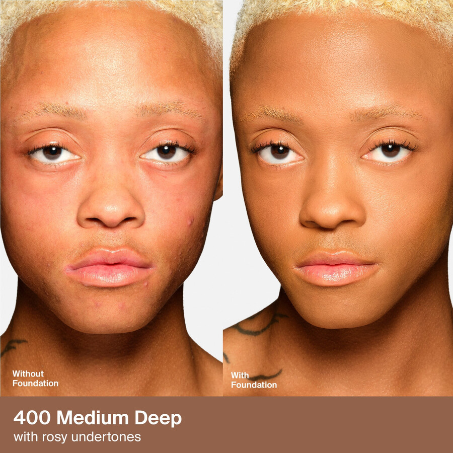 fundația triclone skin tech