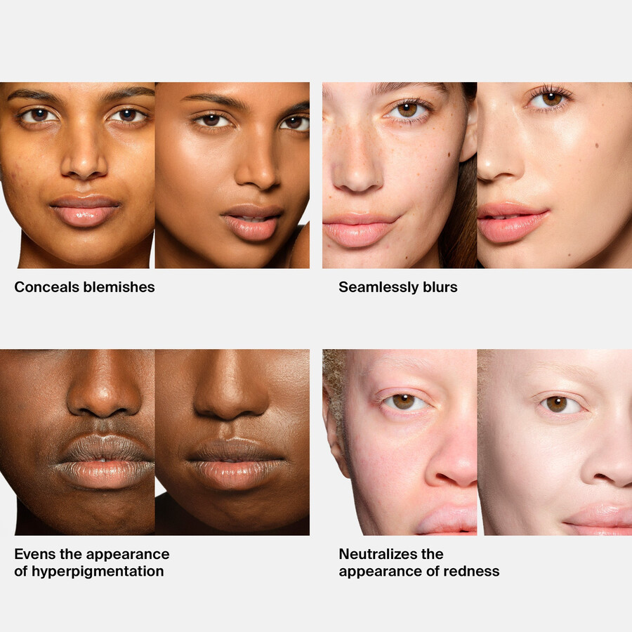 fundația triclone skin tech