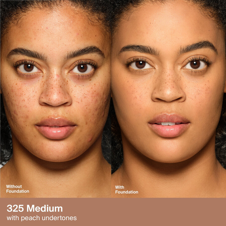 fundația triclone skin tech