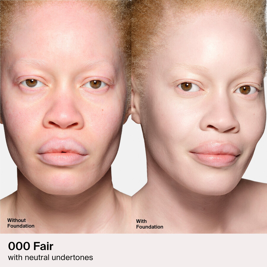 fundația triclone skin tech