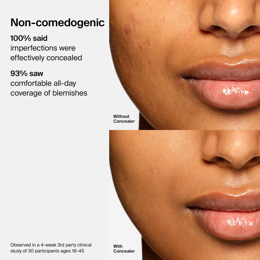 corector triclone skin tech